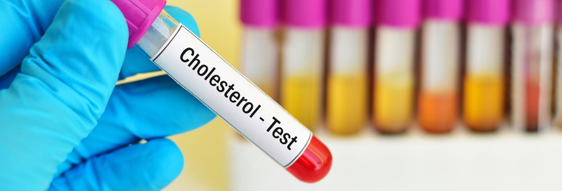 cholesterol